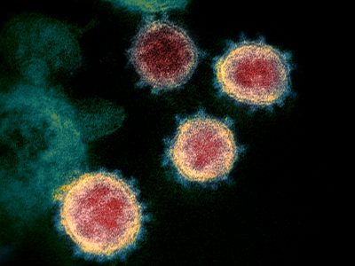 数据专家:抗击冠状病毒的下一步是什么?